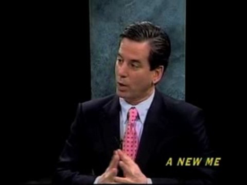 Facelift Surgery Patient Results Maryland Dr. Mark Richards