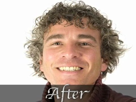 Orange County Natural Hair Replacement