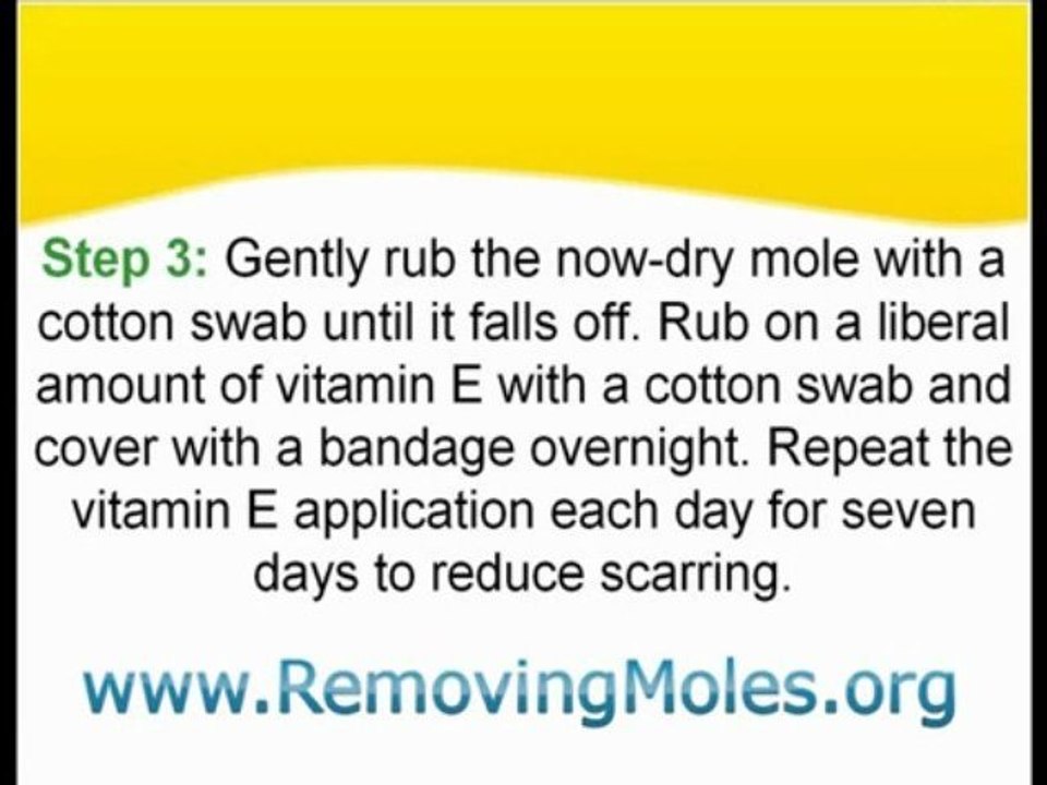 Removing Skin Moles Using Onion and Rock Salt