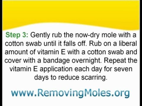 Removing Skin Moles Using Onion and Rock Salt