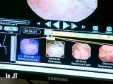 La Vidéo Capsule révolutionne l'imagerie médicale