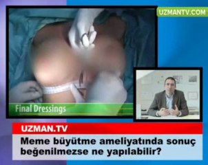 Meme büyütme ameliyatında sonuç beğenilmezse ne yapılabilir