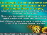 Understanding and Treating Hair Loss