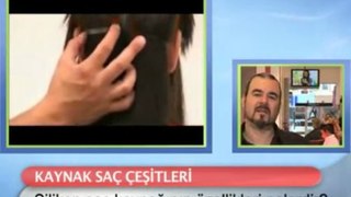 Silikon saç kaynağının özellikleri nelerdir