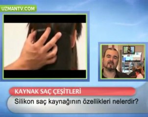 Silikon saç kaynağının özellikleri nelerdir