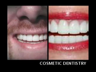 DR JJ EDDERAI EMERGENCY DENTIST NORTH MIAMI BEACH video