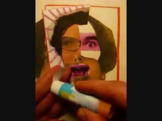 Chirurgie plastique