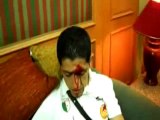 Les joueurs algeriens blessés au Caire