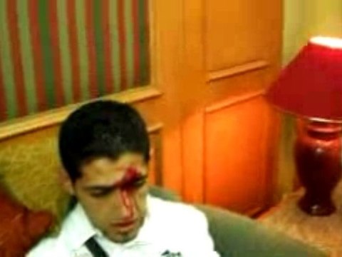 Egypte-Algerie - Les joueurs blessés dans le hall de l'hotel