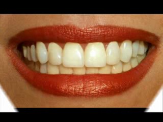 How to find Cheap Dental Insurance