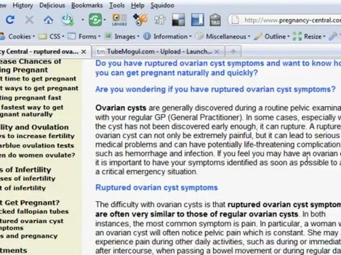 Ruptured Ovarian Cyst Symptoms