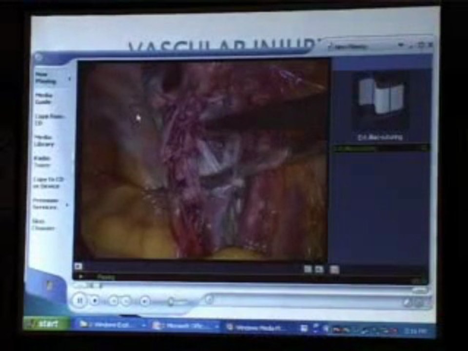 Complications of Laparoscopic Surgery-Video album
