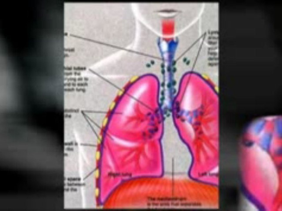Mesothelioma Center