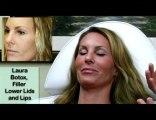 Botox and Restylane to Reduce the Signs of Aging