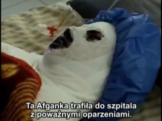 Afganki coraz częściej się podpalają