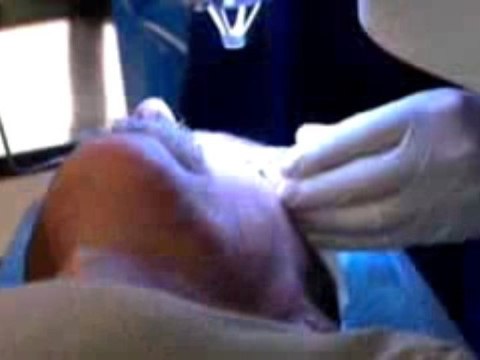 Refractive Lensectomy Surgery Options Barnet Dulaney Perkin