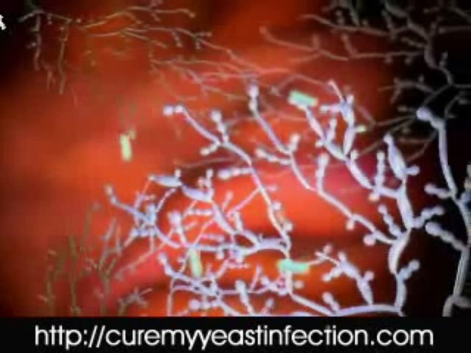Candida treatment Wild Oregano Oil - A Nonpareil Medicine To