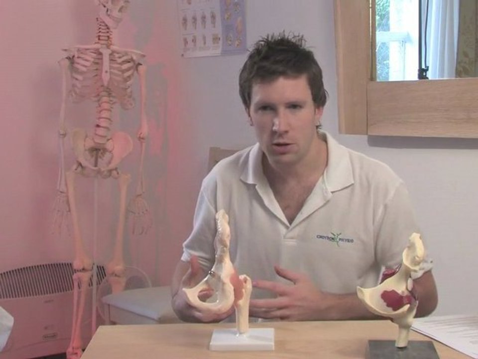 Physiotherapy and osteoarthritis