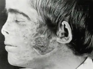 Loup-garou mythe ou réalité 2/2