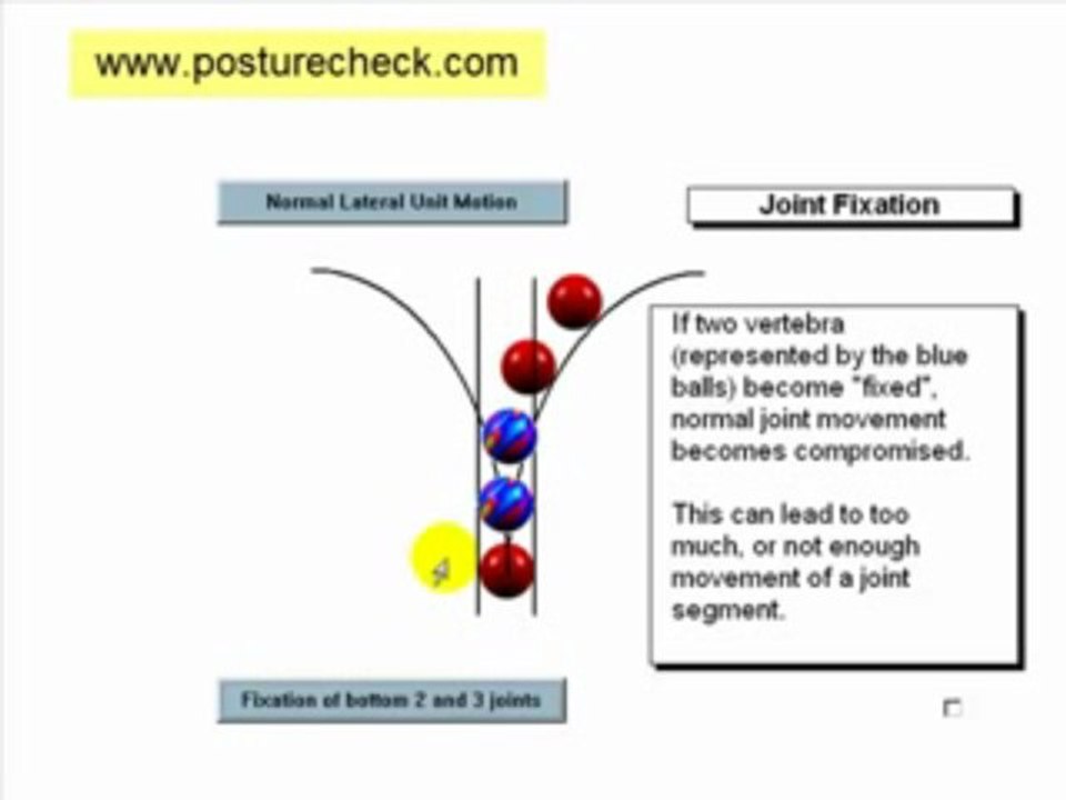 Causes of a Stiff Neck by Charlotte Neck Pain Doctor