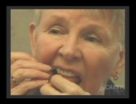 Clean Braces|Family Dental Care|Dentist|Glendale|Dr. Sahabi