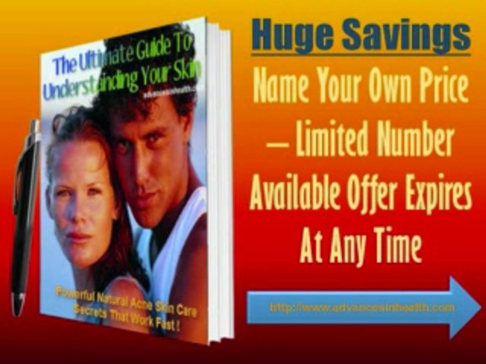 acne treatments at home