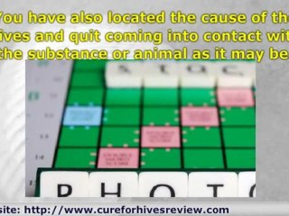 A Cure For Hives That Works!