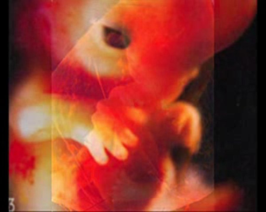FOETUS