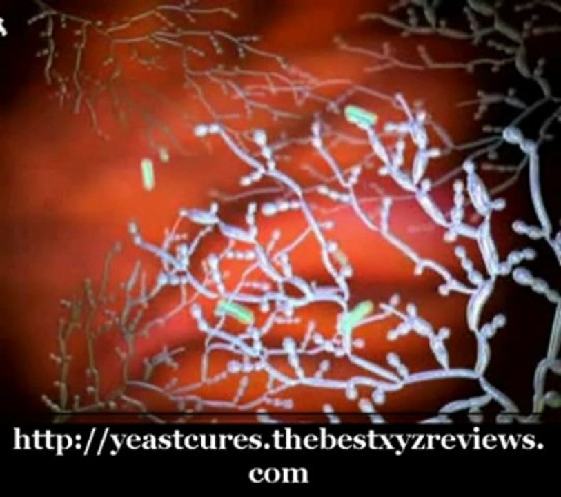 Vaginal yeast cure Vaginal Discharge And Odor Posted By: Mar