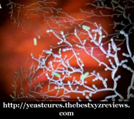 Vaginal yeast cure Vaginal Discharge And Odor Posted By: Mar