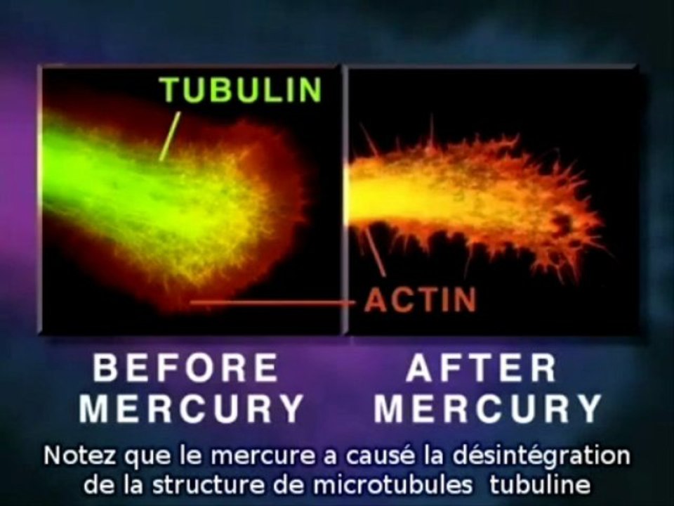 effets du mercure sur les neurones S/T