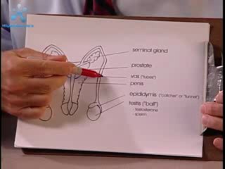 Vasectomy Explained - What Patient's Know