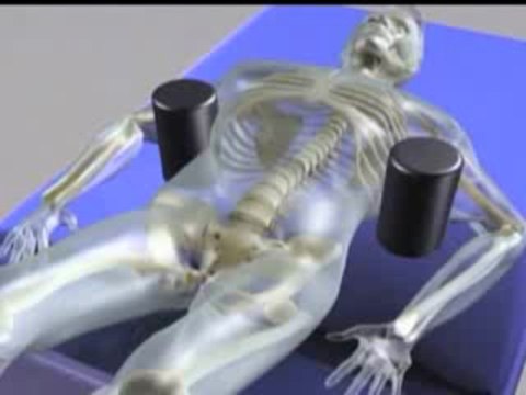 Spinal Decompression Santa Monica, CA | Pinched Nerve