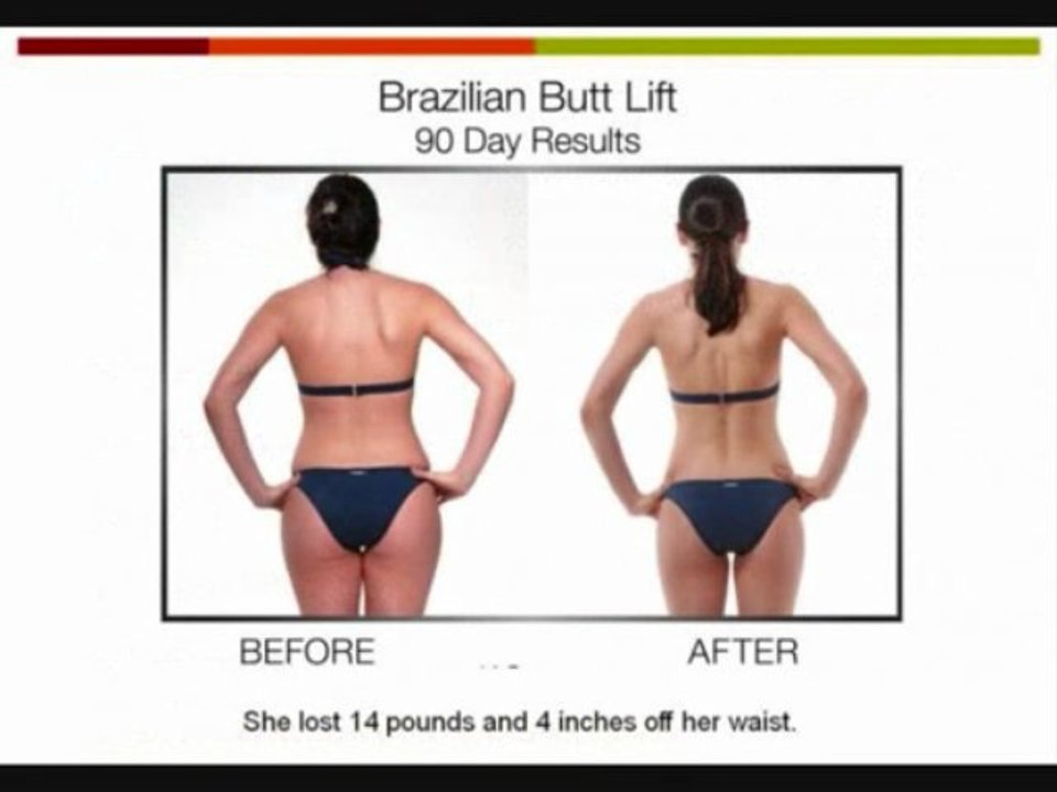 Brazilian Butt Lift *Leandro Cavalho* Triangle Training