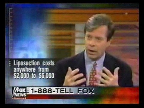 SMART LIPO MPX: SMART LIPO MPX SURGEONS