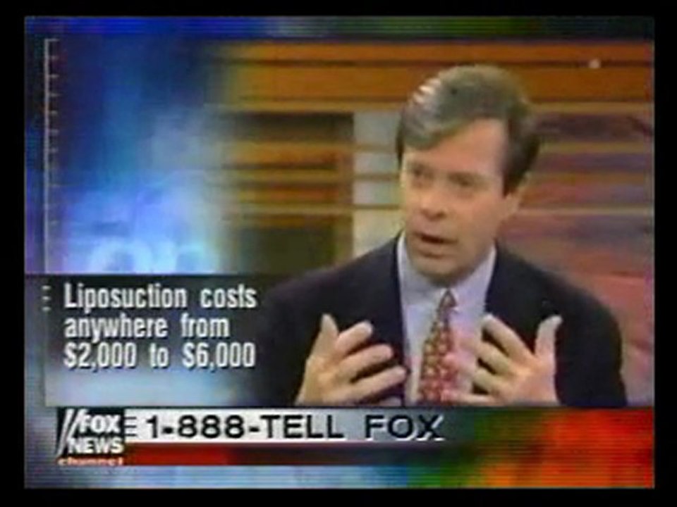 SMART LIPO MPX: SMART LIPO MPX SURGEONS