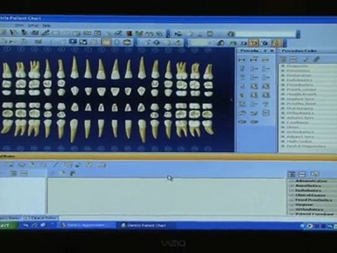 HendersonvilleFamilyDentistry 822-8262, tn dentist