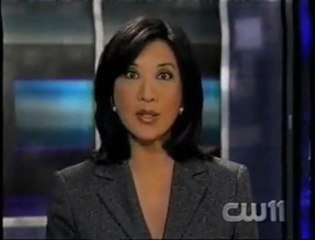 Acid Disconfiguration Surgery Patient - LI Plastic Surgical