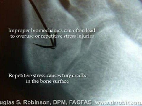 Podiatry Campbell, CA