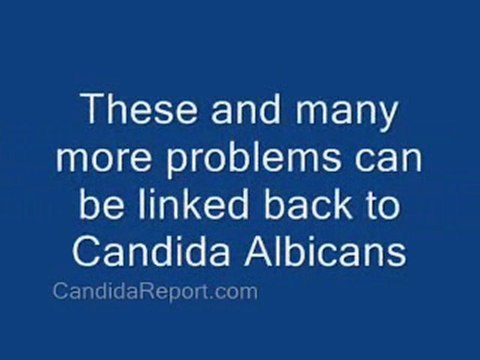 Candidiasis treatment Treatment For Yeast Infections 4 Thing