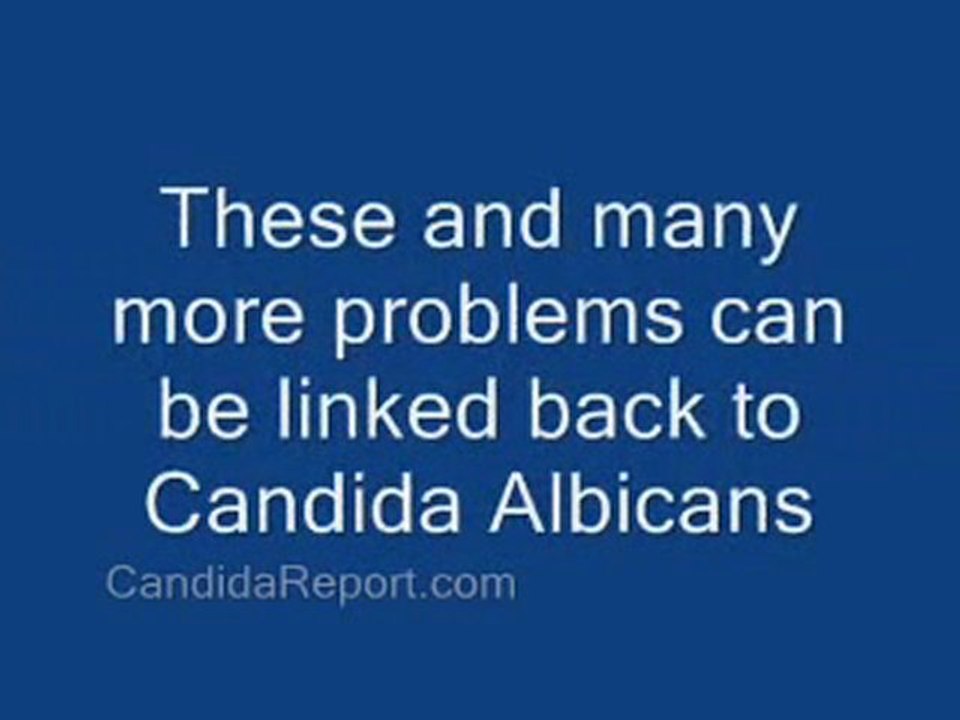 Candidiasis treatment Treatment For Yeast Infections 4 Thing