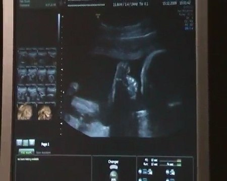 Notre bébé d'amour à 6 mois