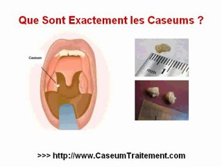 Caséum - Caséums
