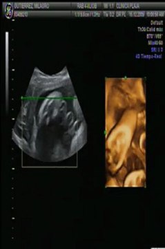 Ultrasonido de mi bb!!