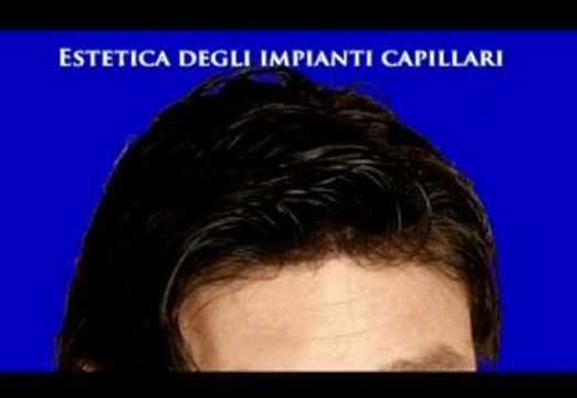 IMPIANTI CAPILLARI luigiuomo.com