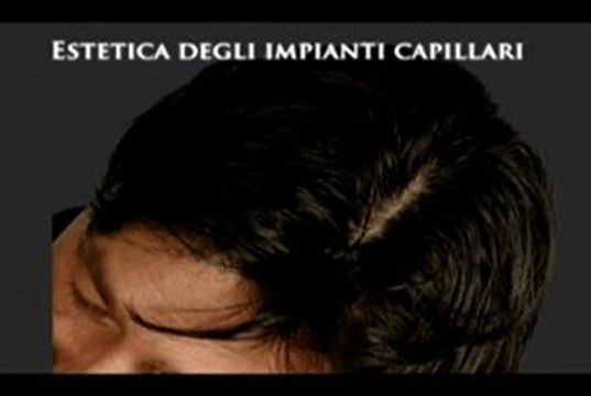 CENTRO IMPIANTI CAPILLARI luigiuomo.com