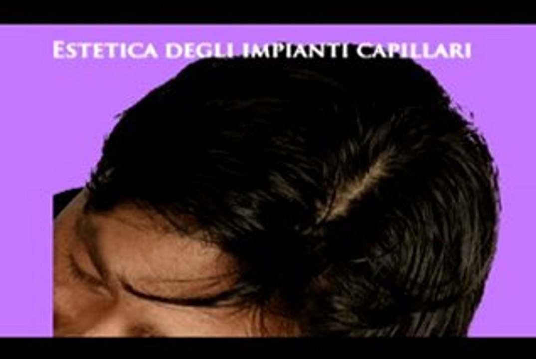 PROTESI CAPELLI www.luigiuomo.com