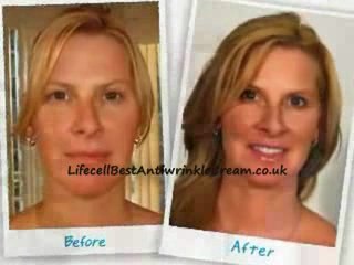 Best Over the Counter Skin Care Cream