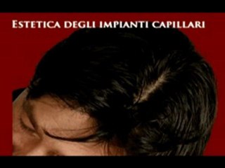 BLOG CALVIZIE www.luigiuomo.com