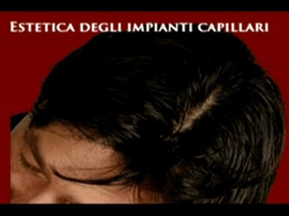 BLOG RICRESCITA CAPELLI www.luigiuomo.com